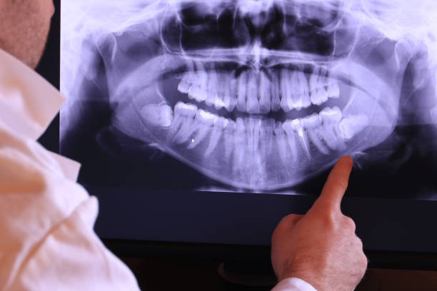 Best Emergency Root Canal Treatment in Deephaven, MN